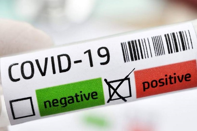 Covid19: «Βράζει» η Volleyleague-Σκέψεις για 10ήμερη διακοπή